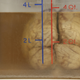 A human brain at Georgetown University Medical Center in Washington
